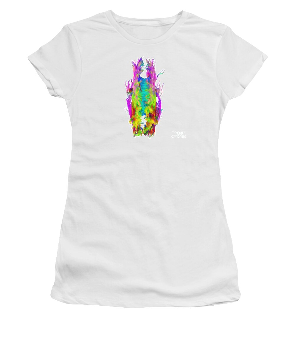 Brain Mri Women's T-Shirt featuring the photograph Brain Fiber Tracts, Dti Scan #3 by Living Art Enterprises