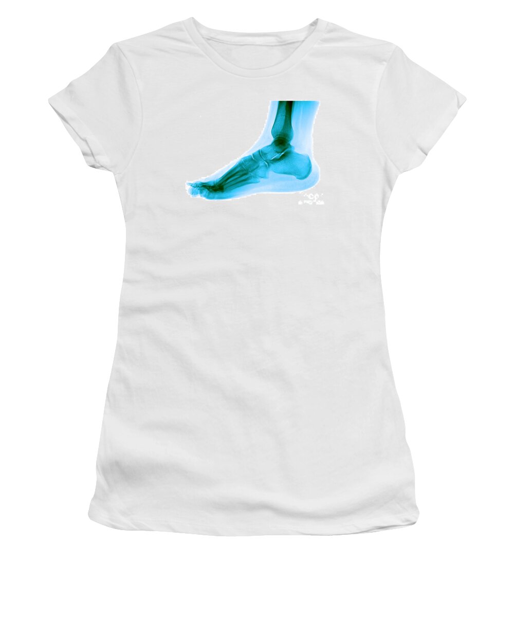 Anatomy Women's T-Shirt featuring the photograph Foot #4 by Medical Body Scans