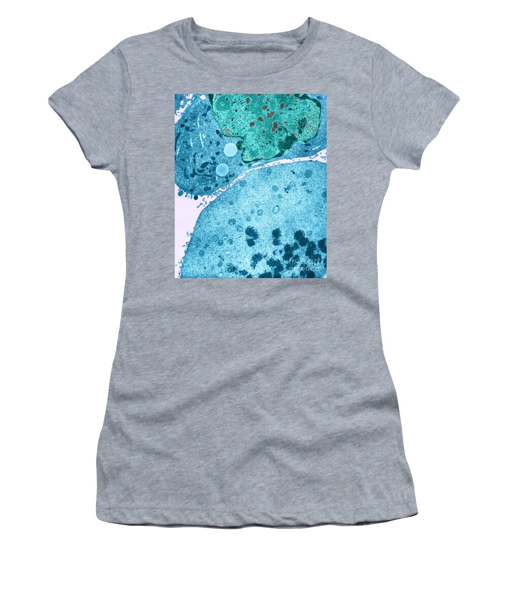 Science Women's T-Shirt featuring the photograph Kb Cell Infected With Adenovirus Tem #2 by David M. Phillips