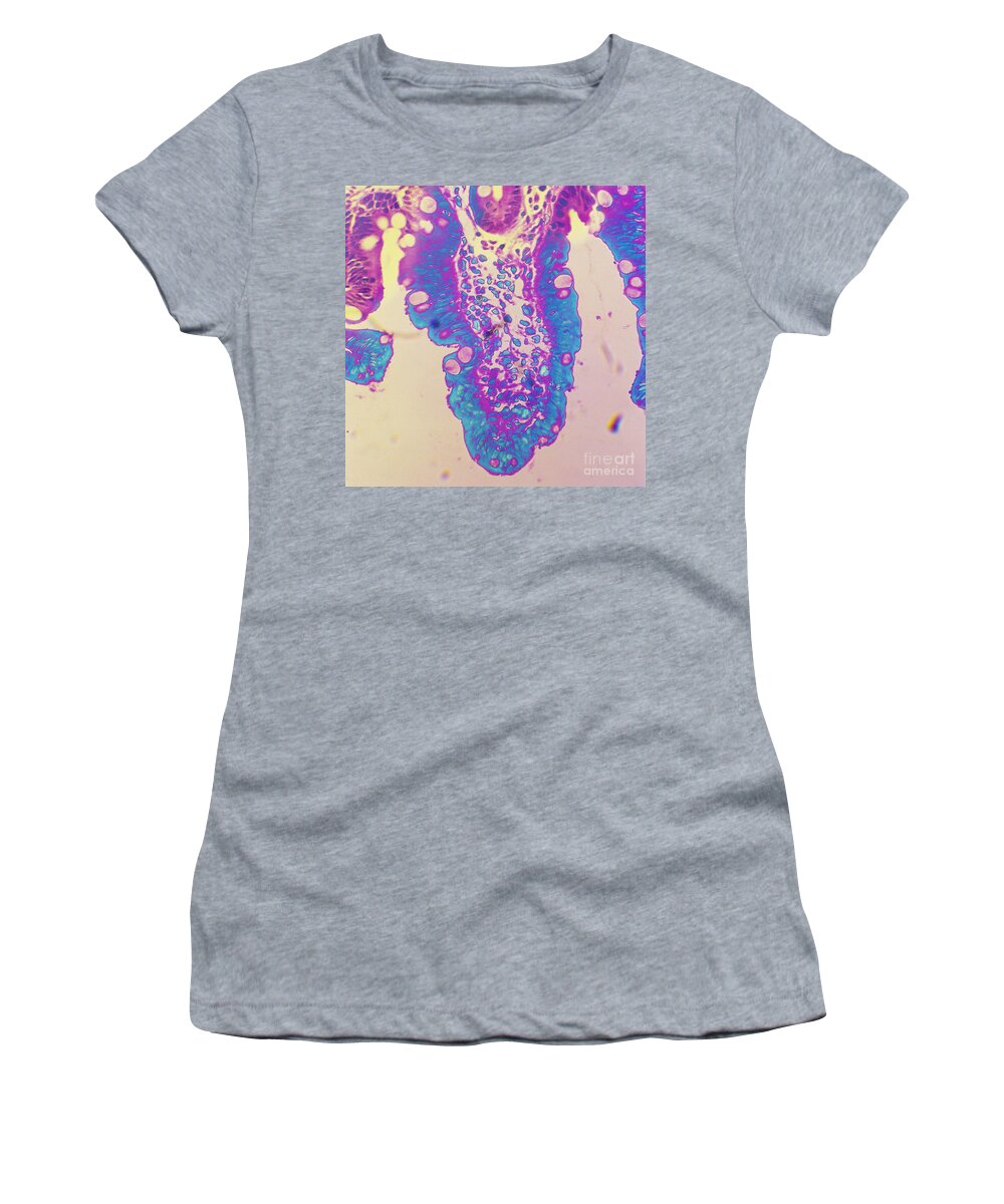 Histology Women's T-Shirt featuring the photograph Cryptosporidium In Intestine Of Baby by Dr. Cecil H. Fox