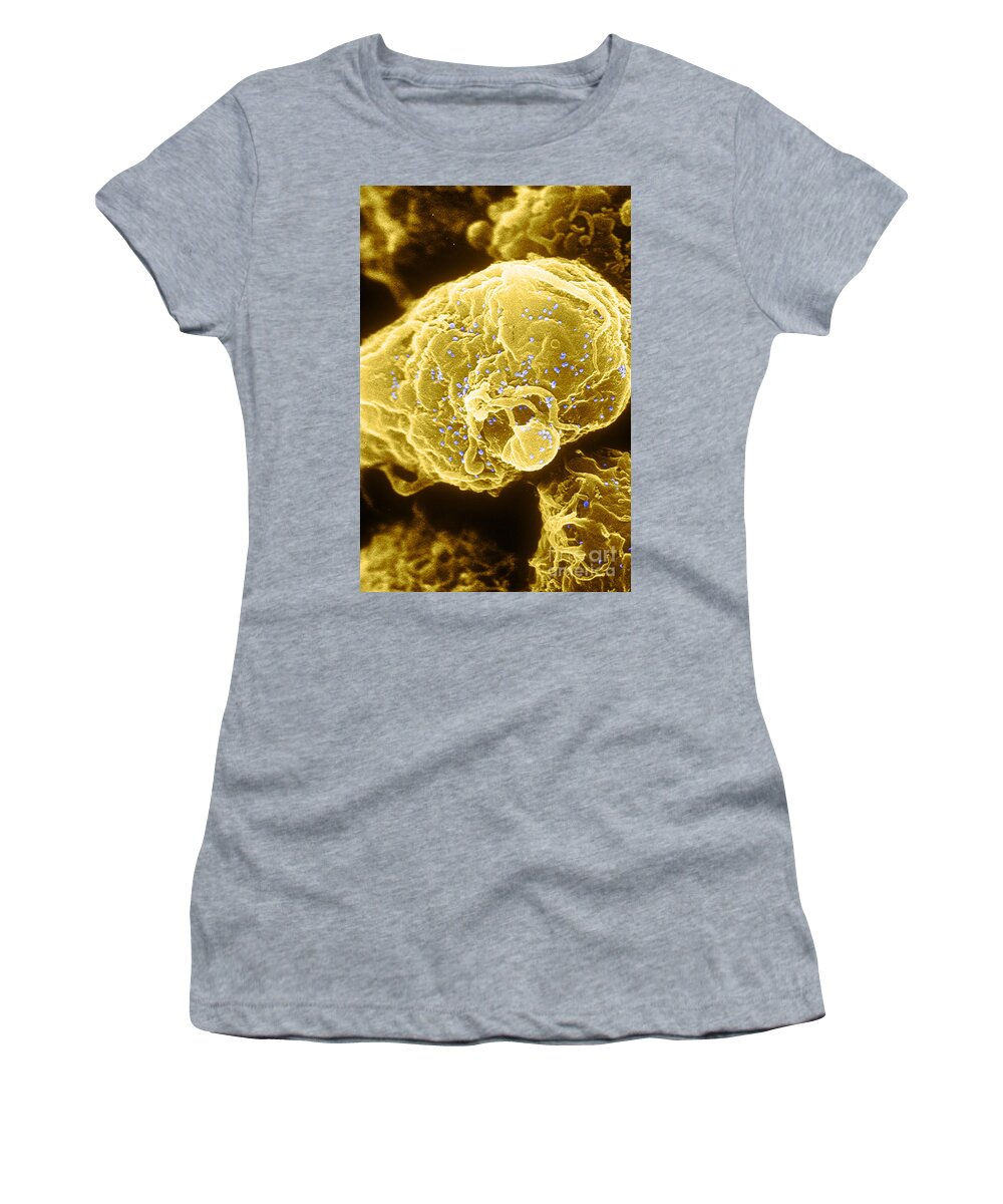 Medical Women's T-Shirt featuring the photograph Hiv-1 Infected T4 Lymphocyte Sem #1 by Science Source