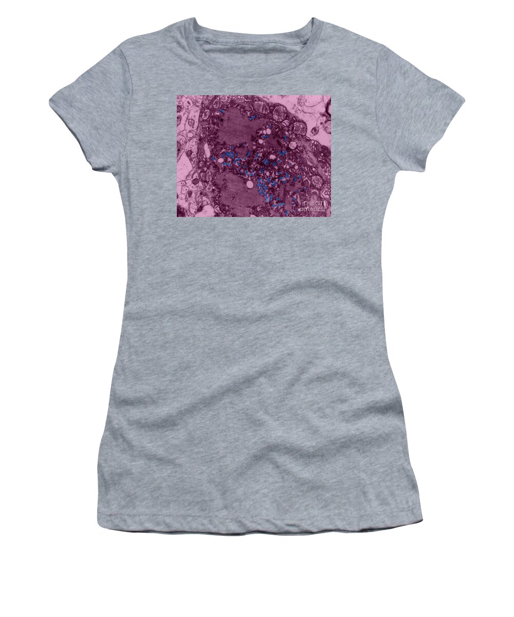 Rabies Women's T-Shirt featuring the photograph Rabies Virus, Tem #1 by Science Source