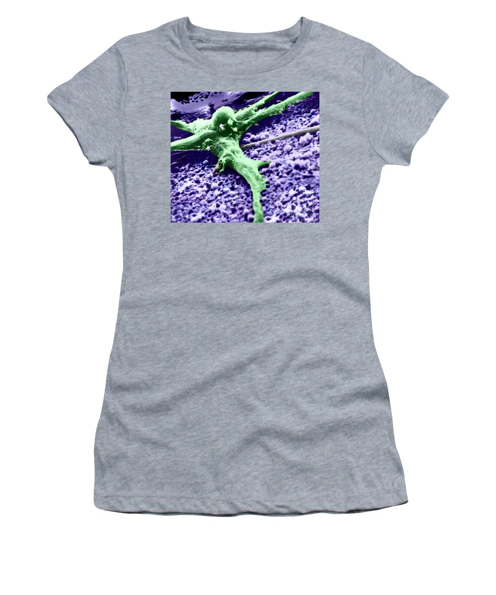 Cancer Women's T-Shirt featuring the photograph Malignant Cancer Cell #6 by Omikron