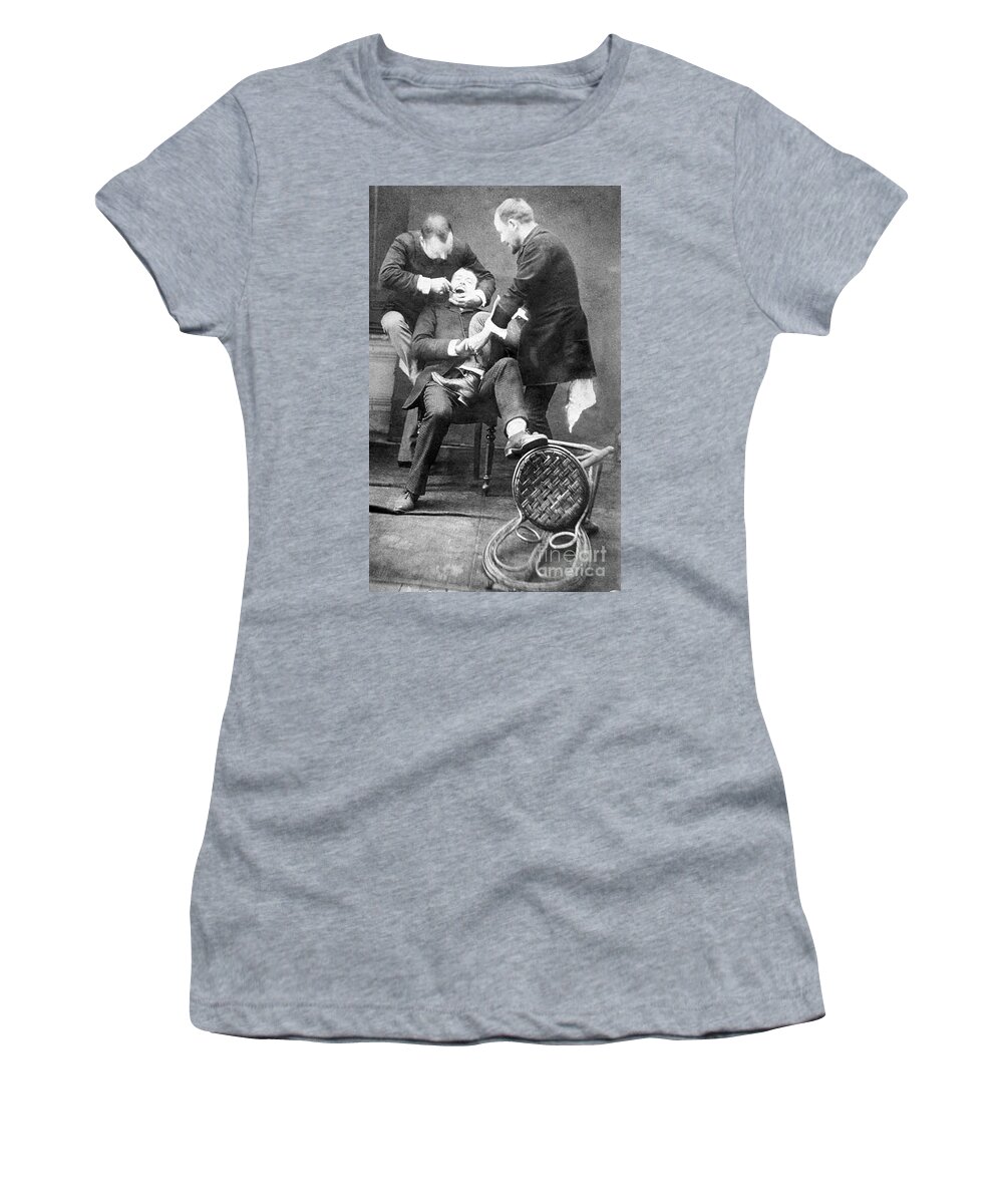 History Women's T-Shirt featuring the photograph Dentistry Tooth Extraction 1892 by Science Source