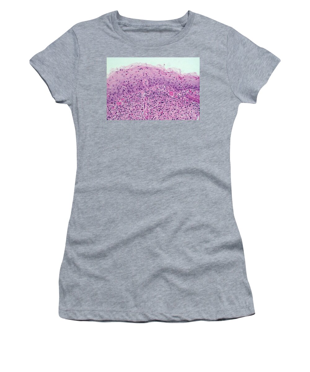 Light Micrograph Women's T-Shirt featuring the photograph Healthy Cervix, Lm by M. I. Walker