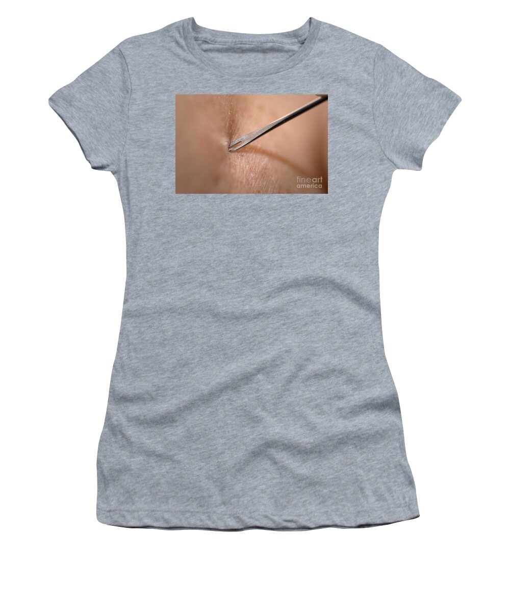 Science Women's T-Shirt featuring the photograph Smallpox Vaccination, Bifurcated Needle by Science Source