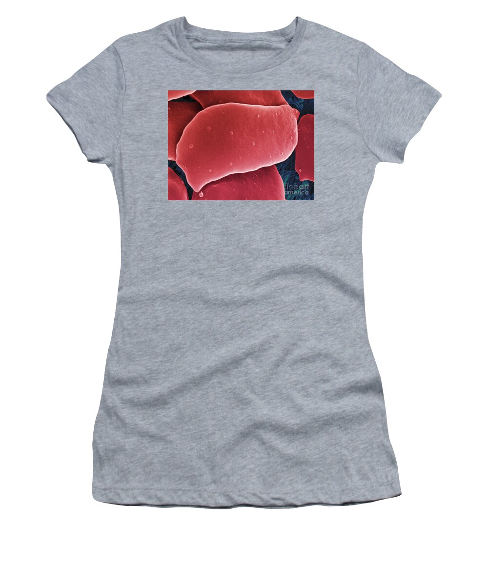 Science Women's T-Shirt featuring the photograph Blood Platelets, Sem #2 by Ted Kinsman