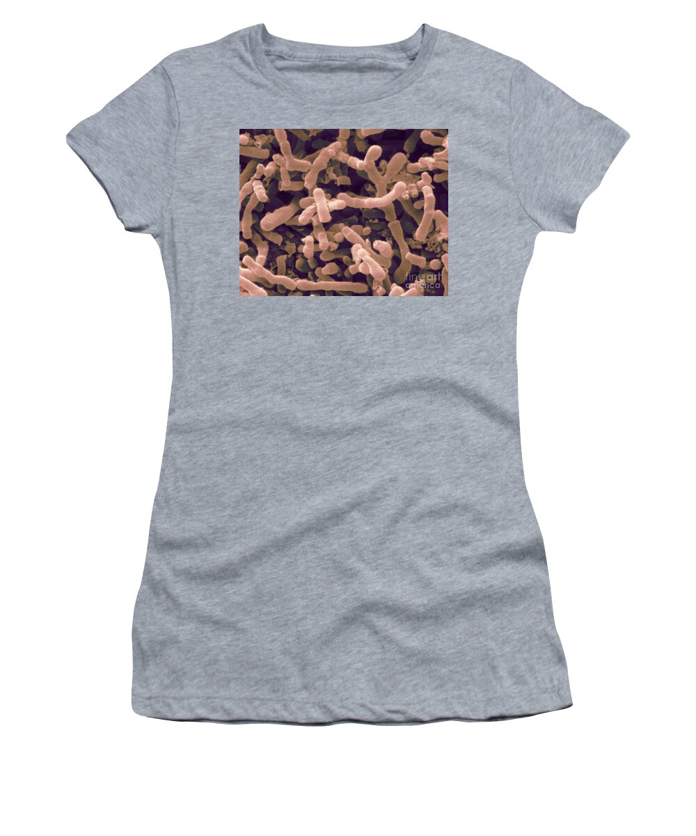 Bifidobacterium Longum Women's T-Shirt featuring the photograph Bifidobacterium Longum, Sem by Scimat