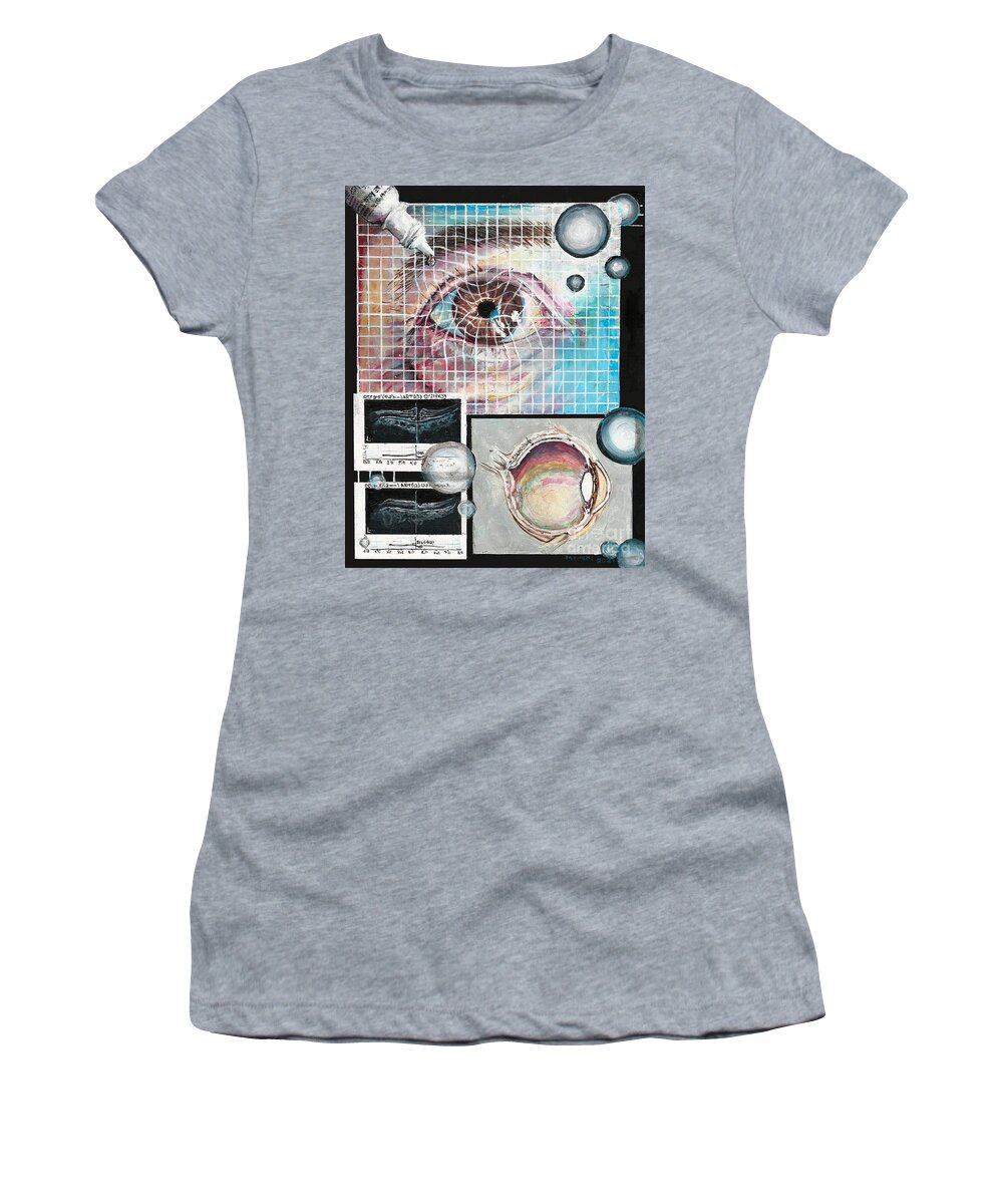 Eye Women's T-Shirt featuring the painting Macular Hole Repair by Merana Cadorette