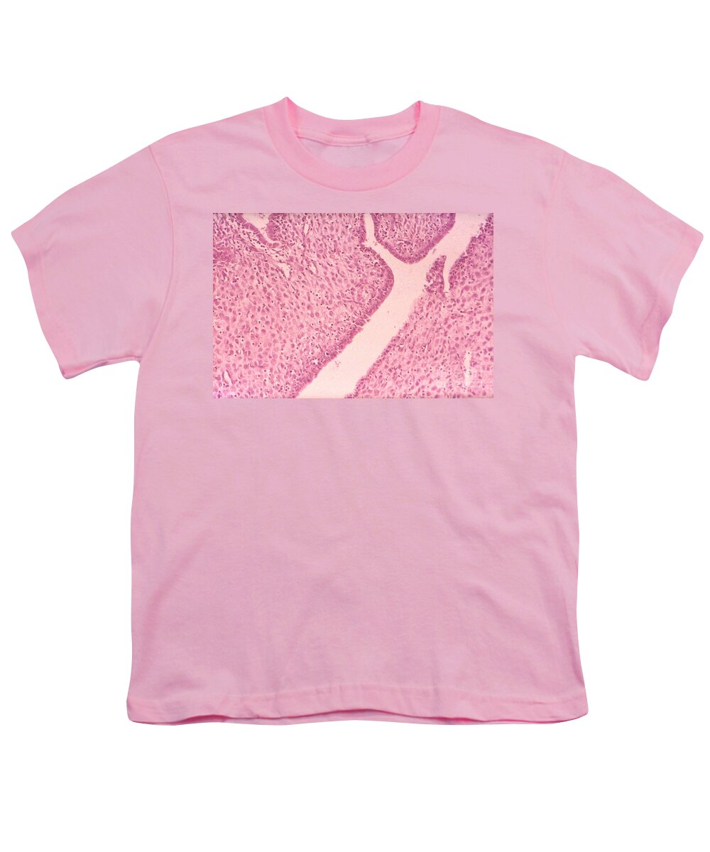 Science Youth T-Shirt featuring the photograph Decidual Cells Lm by M. I. Walker