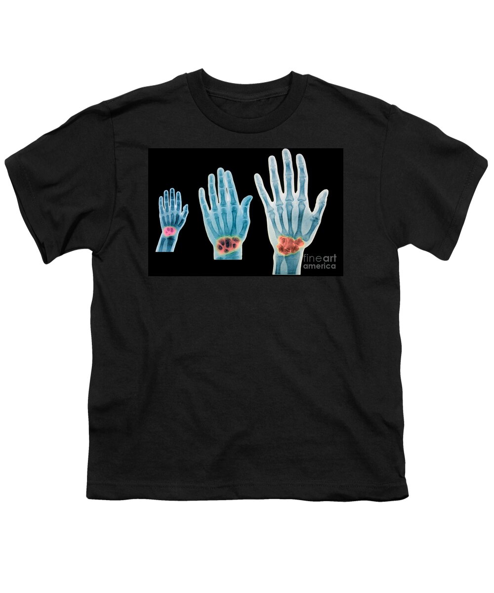 X-ray Of Hands Youth T-Shirt featuring the photograph X-rays Of 2 Year Old, 7 Year Old #1 by Scott Camazine & Sue Trainor