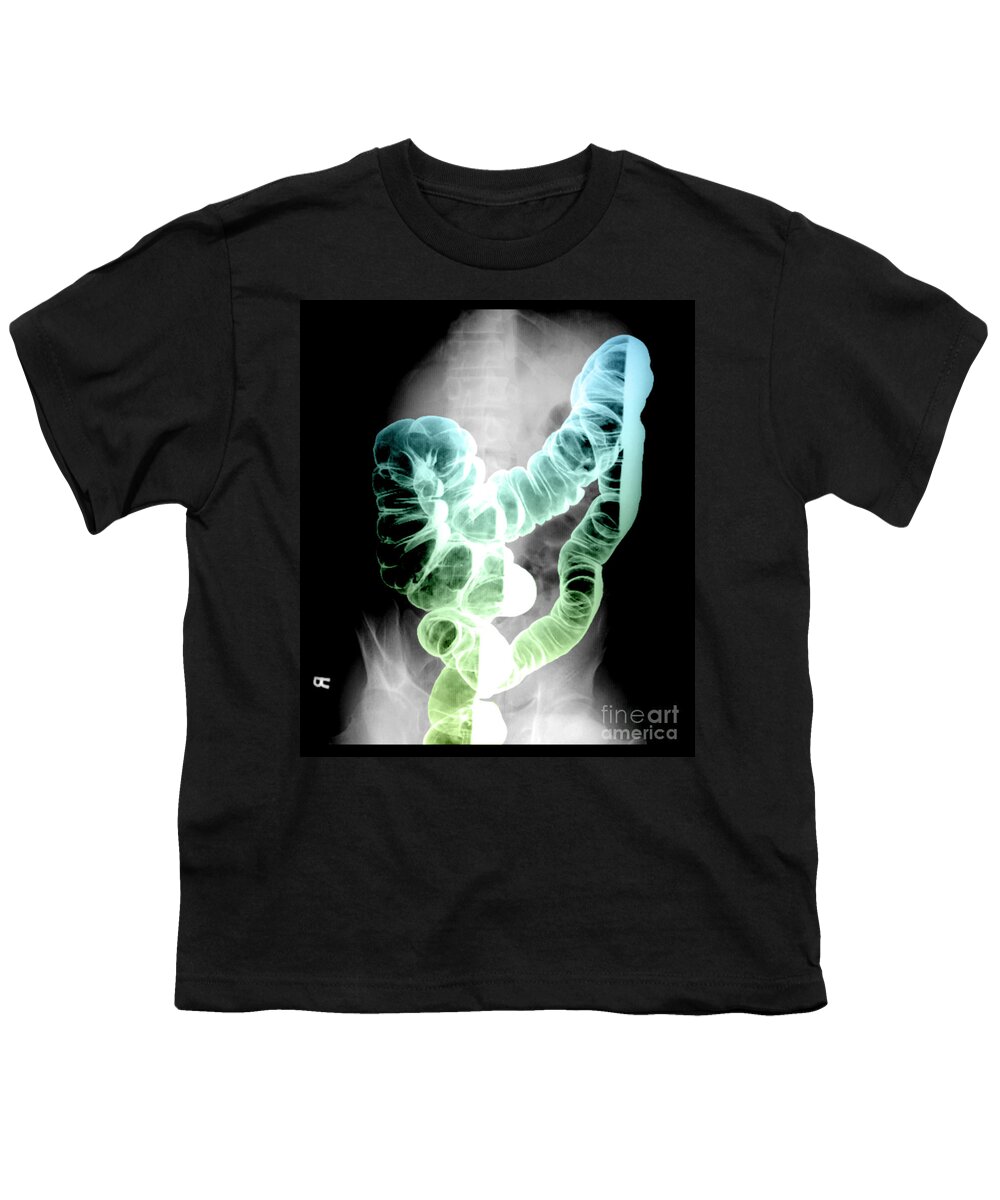 Xray Youth T-Shirt featuring the photograph Barium Enema #2 by Living Art Enterprises, LLC