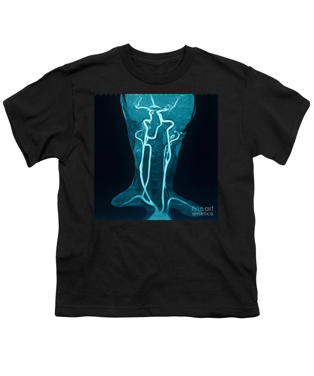 Medical Youth T-Shirt featuring the photograph Circle Of Willis by Susan Leavines