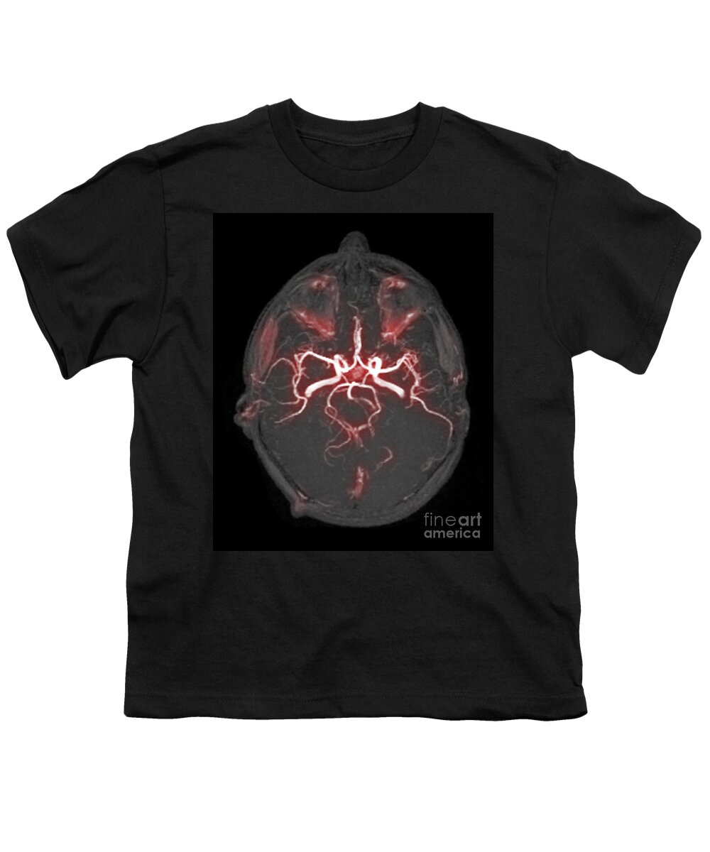 Science Youth T-Shirt featuring the photograph Circle Of Willis, Angiogram by Scott Camazine