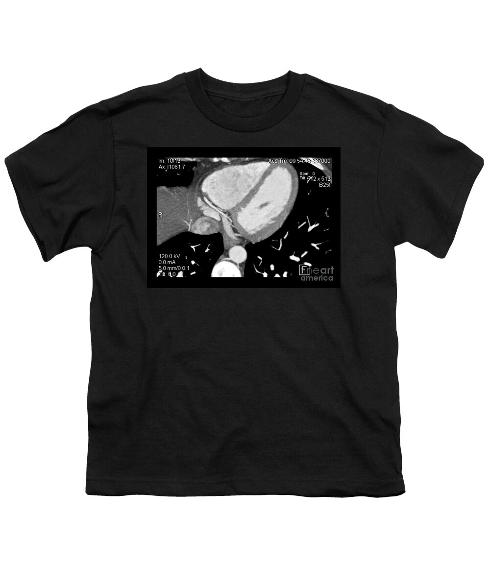 Cardiac Cta Youth T-Shirt featuring the photograph Cardiac Ct Angiography #1 by Medical Body Scans