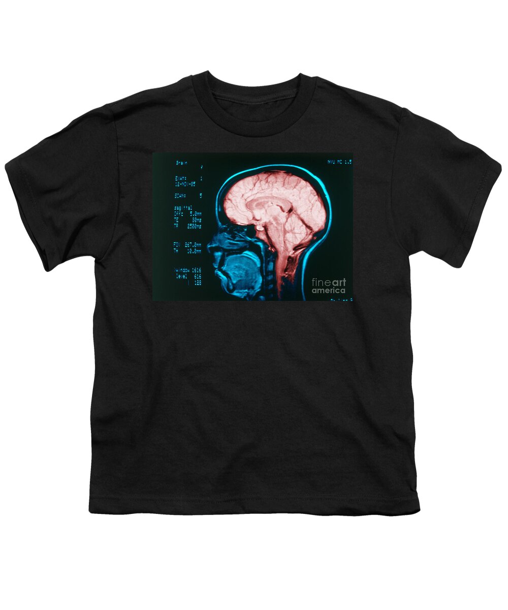 Angiography Youth T-Shirt featuring the photograph Cerebral Angiography by Science Source
