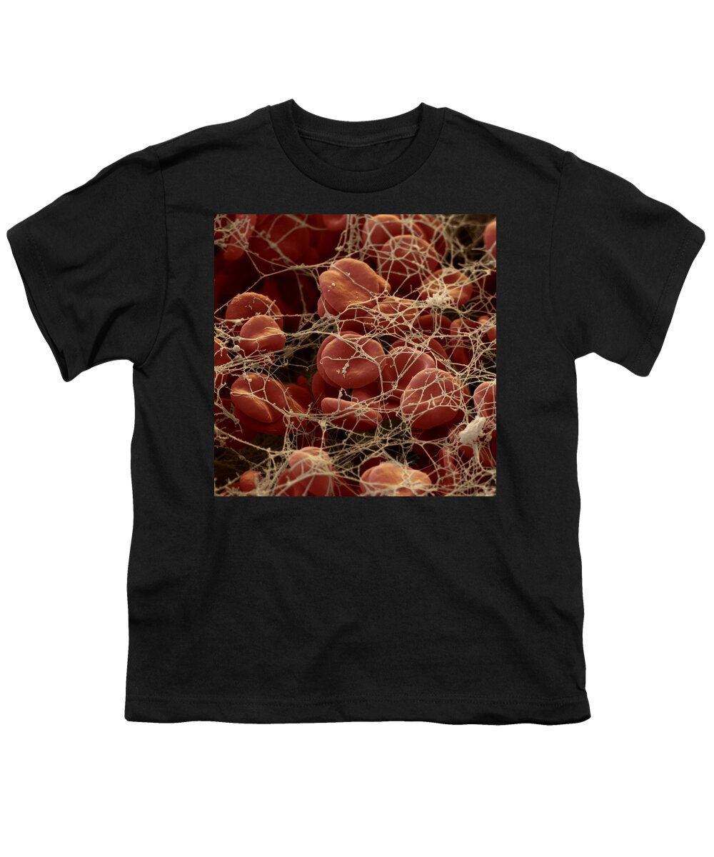 Blood Youth T-Shirt featuring the photograph Blood Clot #1 by Oliver Meckes EYE OF SCIENCE