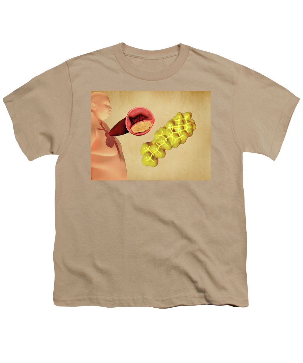 Art Youth T-Shirt featuring the photograph Cholesterol And Atherosclerosis, Artwork by Juan Gaertner