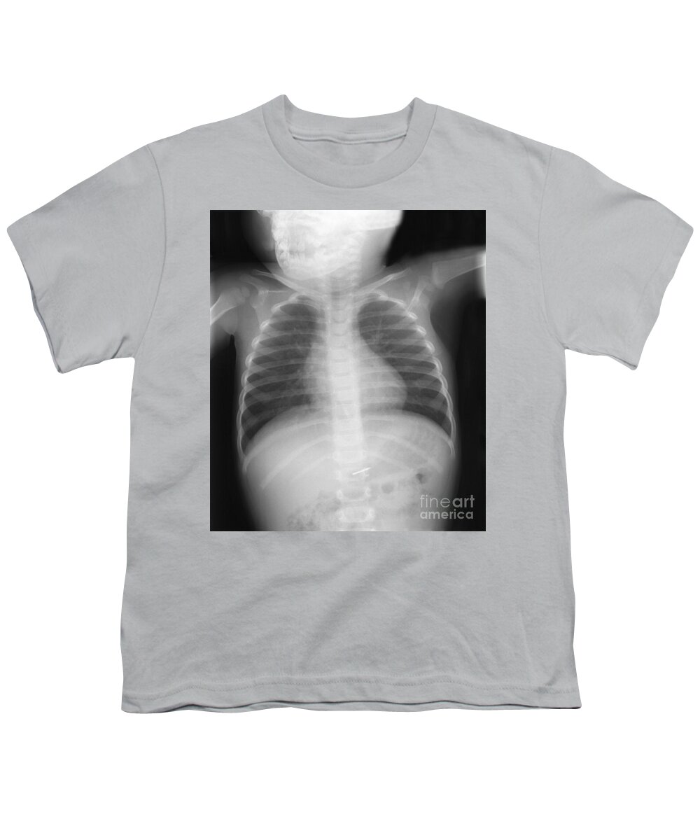 Nail Youth T-Shirt featuring the photograph Swallowed Nail #2 by Ted Kinsman