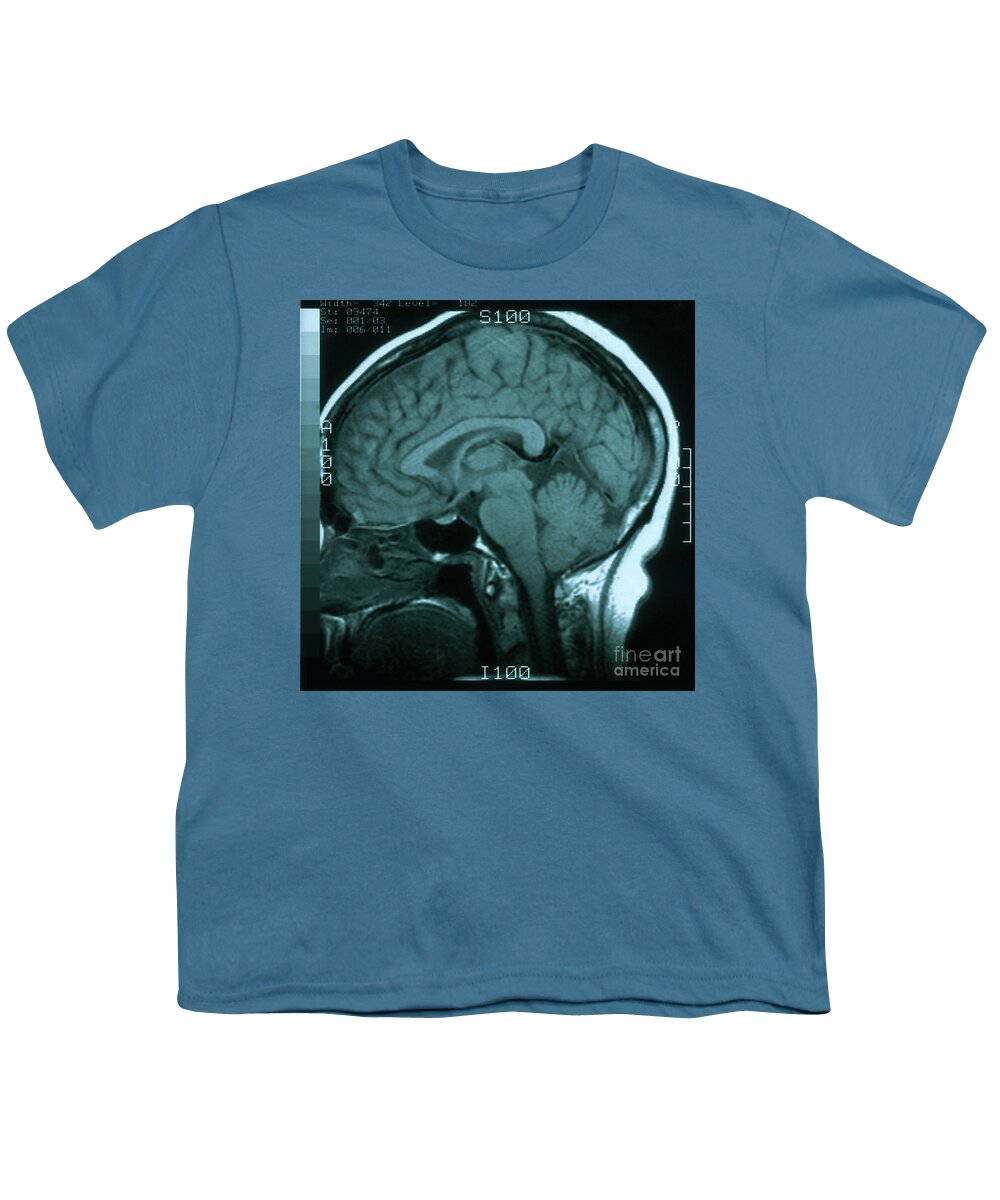 Brain Youth T-Shirt featuring the photograph Mri Of Normal Brain #2 by Science Source