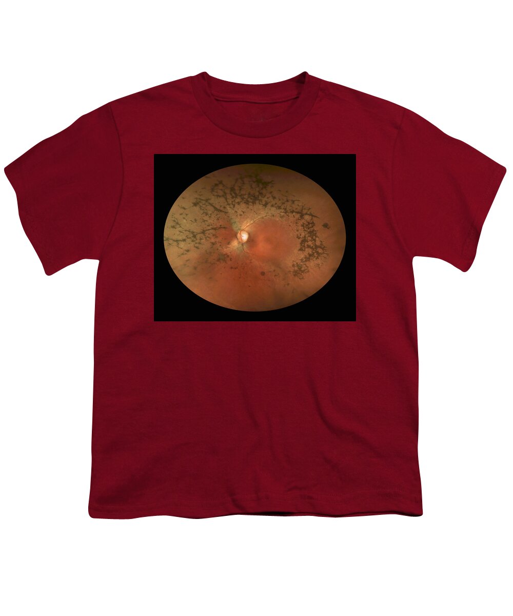 Abnormal Youth T-Shirt featuring the photograph Bone Spicules by Paul Whitten