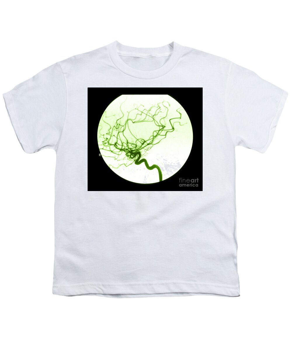 Cerebral Angiogram Youth T-Shirt featuring the photograph Internal Carotid Cerebral Angiogram #1 by Medical Body Scans