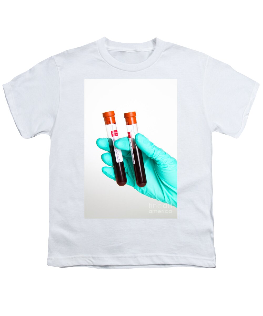 Biochemistry Youth T-Shirt featuring the photograph Blood Samples #2 by Photo Researchers
