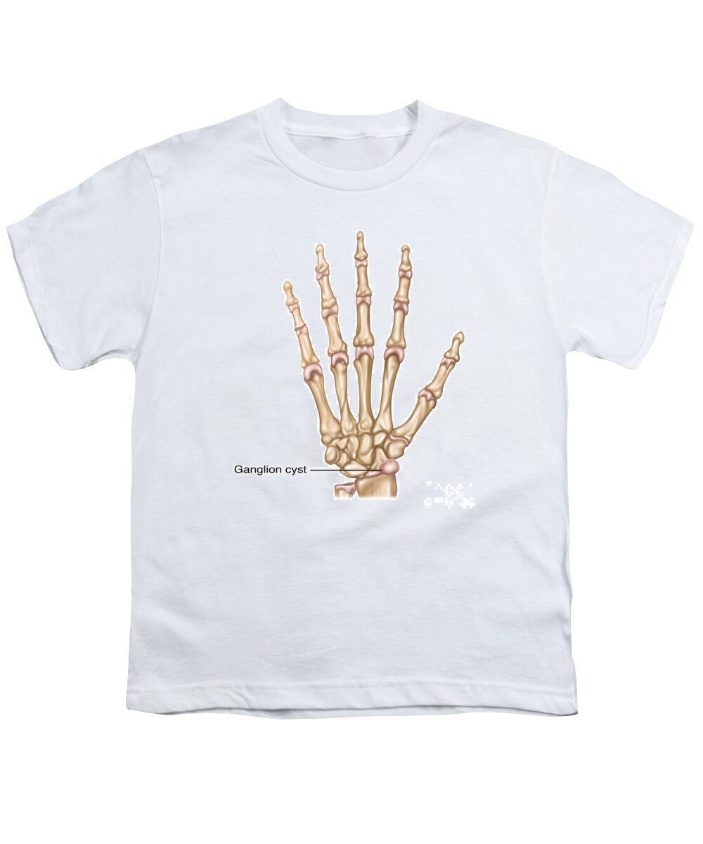 Ganglion Youth T-Shirt featuring the photograph Ganglion Cyst, Illustration #2 by Gwen Shockey