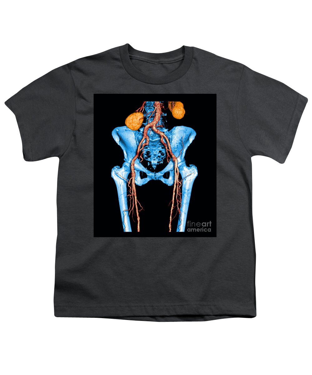 Anatomy Youth T-Shirt featuring the photograph Pelvis And Upper Legs by Medical Body Scans