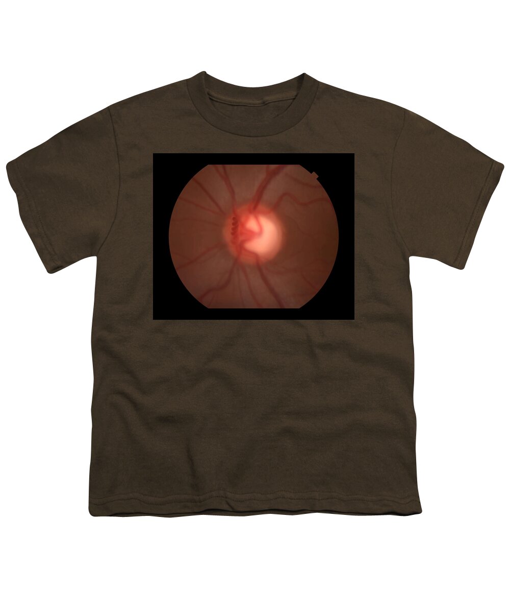 Abnormal Youth T-Shirt featuring the photograph Congenital Vascular Loop #1 by Paul Whitten