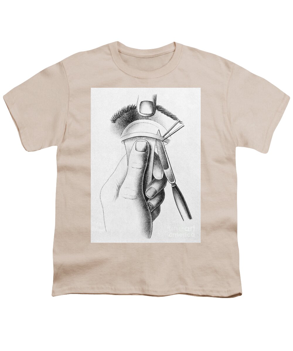 History Youth T-Shirt featuring the photograph Surgery To Correct Lazy Upper Eyelid by Science Source