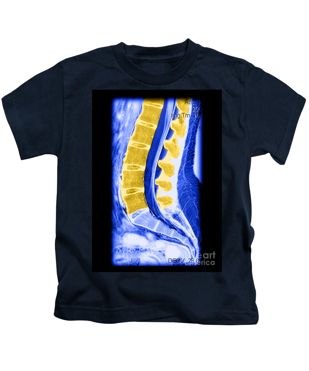 Anatomy Kids T-Shirt featuring the photograph Normal Lumbar Spine #1 by Medical Body Scans