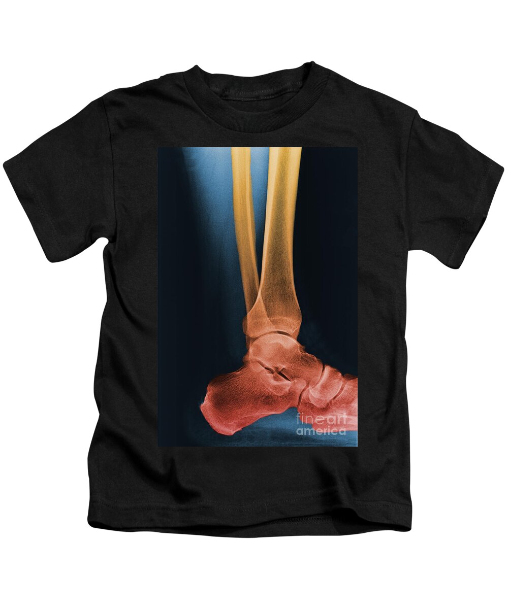 Anatomy Kids T-Shirt featuring the photograph Foot X-ray #1 by Ted Kinsman