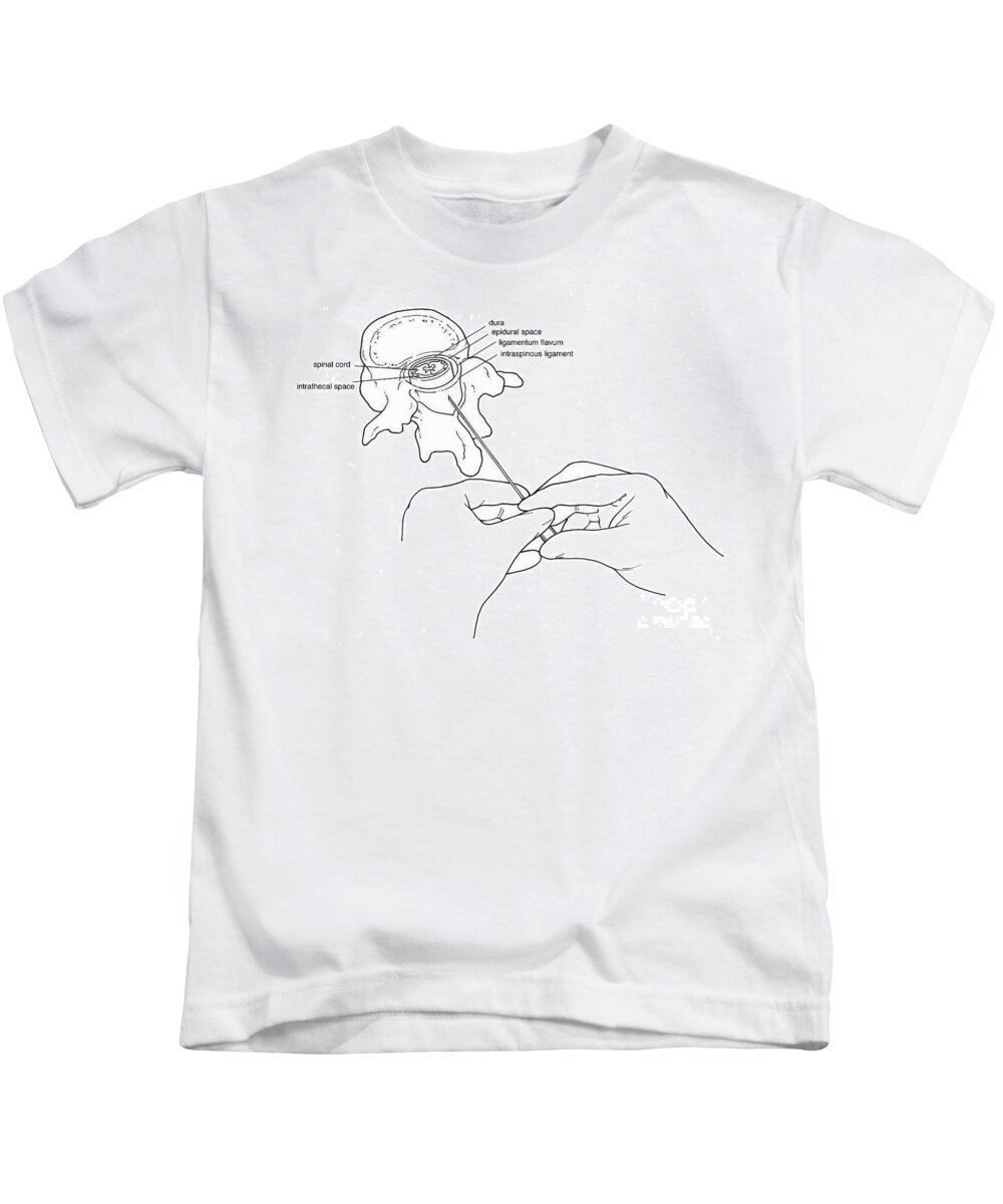 Anatomy Kids T-Shirt featuring the photograph Illustration Of Lumbar Puncture Spinal #5 by Science Source