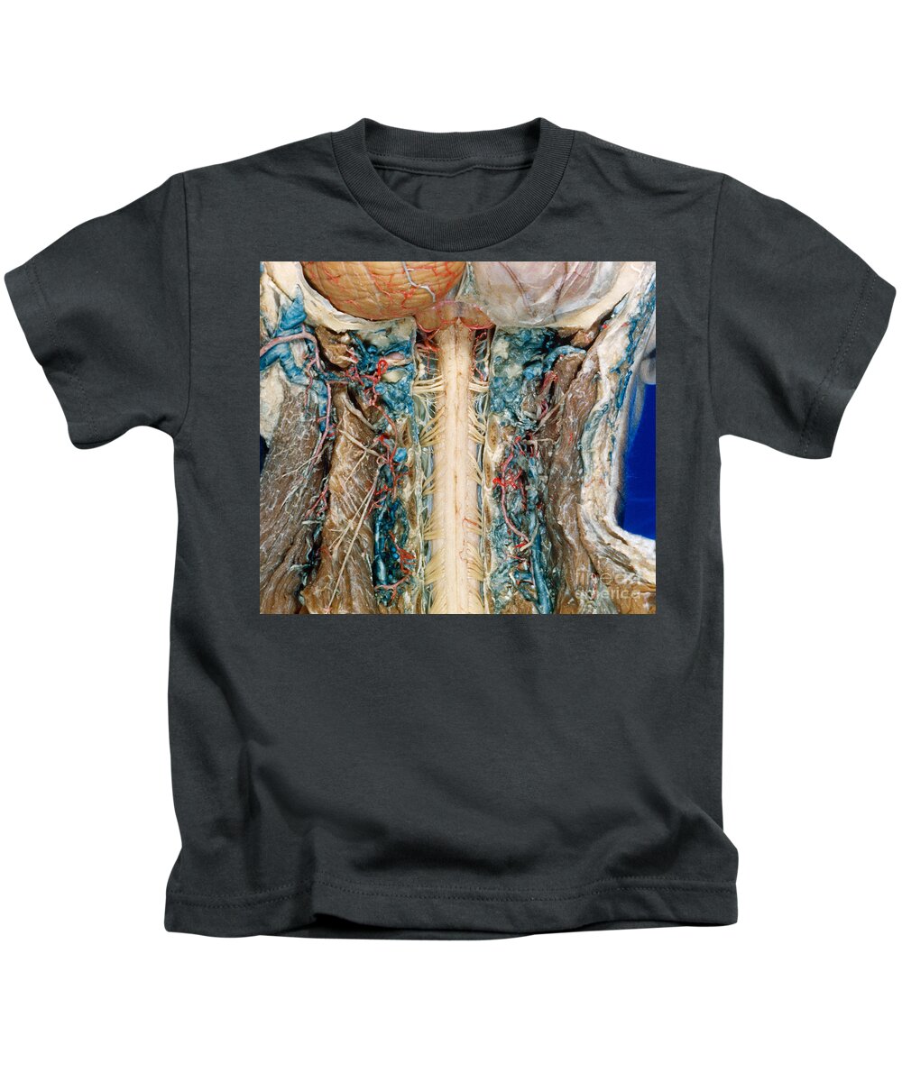 Anatomy Kids T-Shirt featuring the photograph Cervical Spinal Cord, Posterior View by VideoSurgery