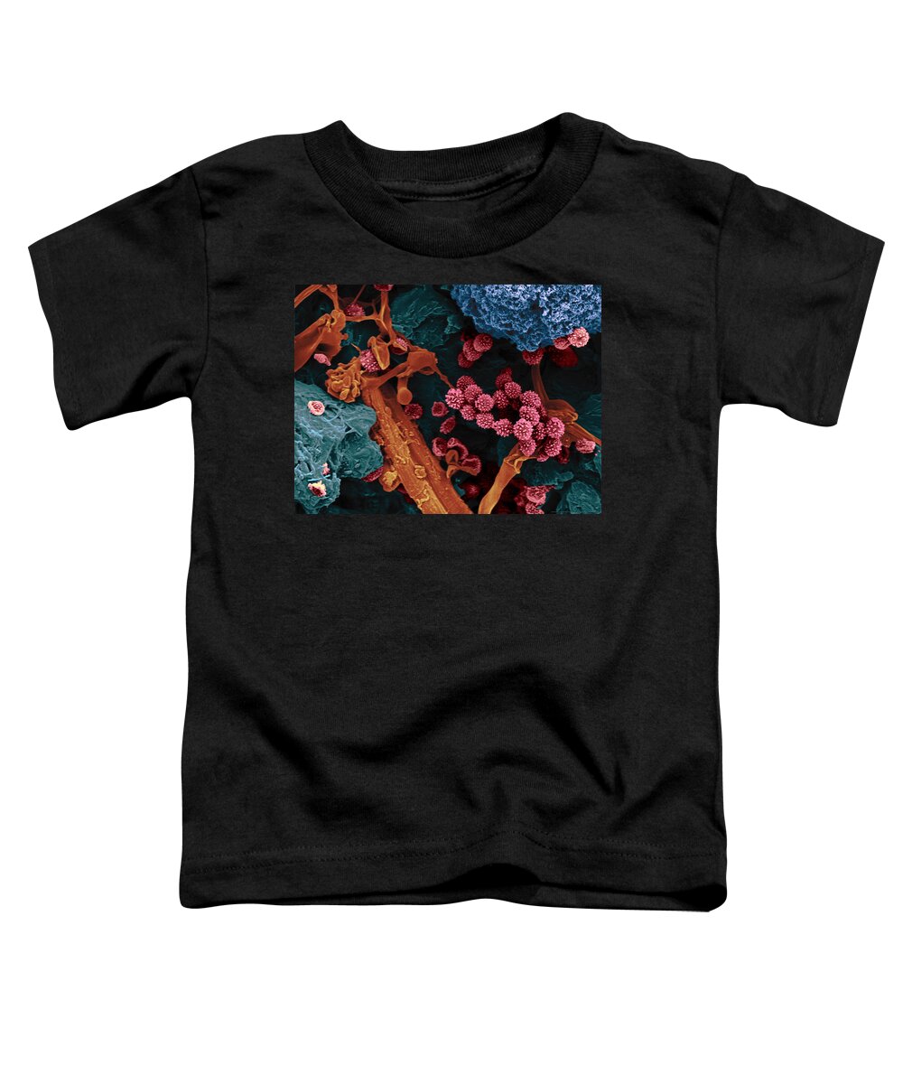 Fungus Toddler T-Shirt featuring the photograph Dark Ceiling Mold, Sem #2 by Scimat