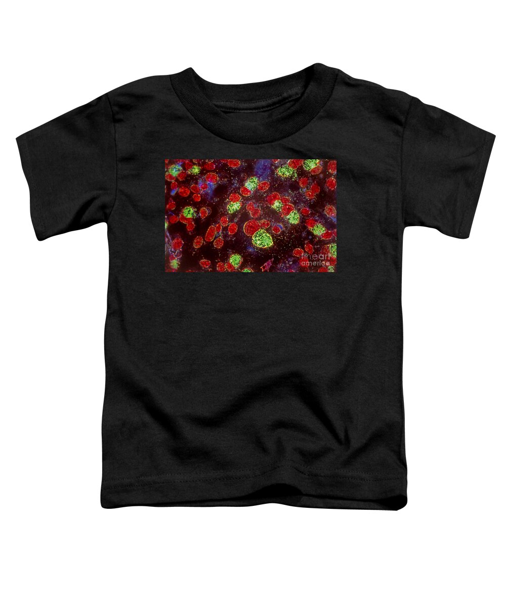 Micrography Toddler T-Shirt featuring the photograph Chlamydia Infected Culture by M I Walker