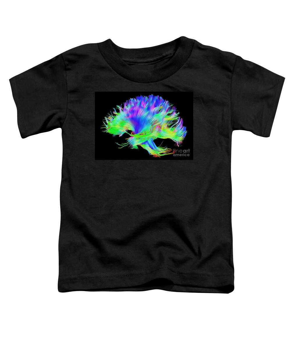 Brain Mri Toddler T-Shirt featuring the photograph Fiber Tracts Of The Brain, Dti #4 by Living Art Enterprises