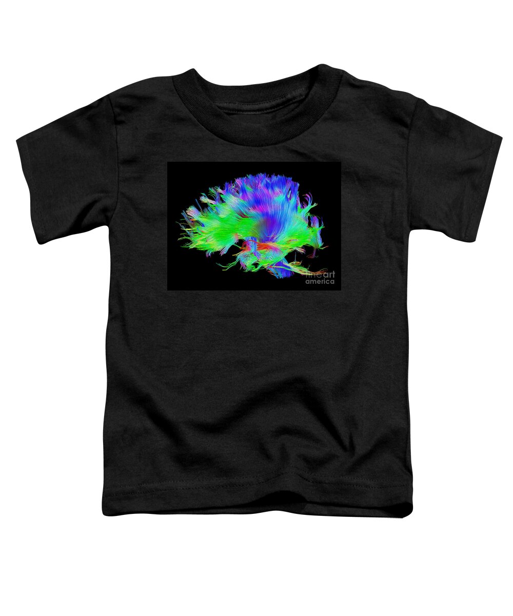 Brain Mri Toddler T-Shirt featuring the photograph Fiber Tracts Of The Brain, Dti #3 by Living Art Enterprises