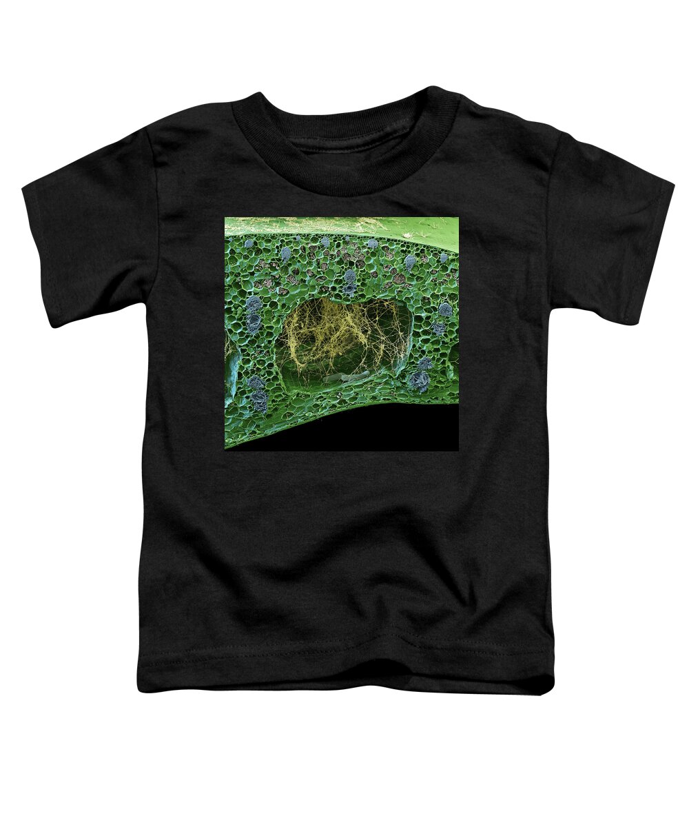 Banana Toddler T-Shirt featuring the photograph Fusarium Oxysporum, Sem by Oliver Meckes EYE OF SCIENCE