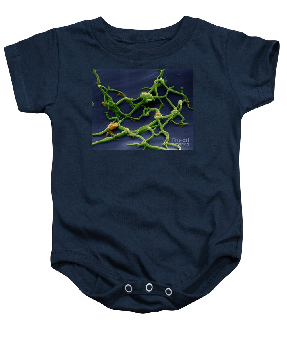 Micrograph Baby Onesie featuring the photograph Borrelia Burgdorferi by Eye of Science