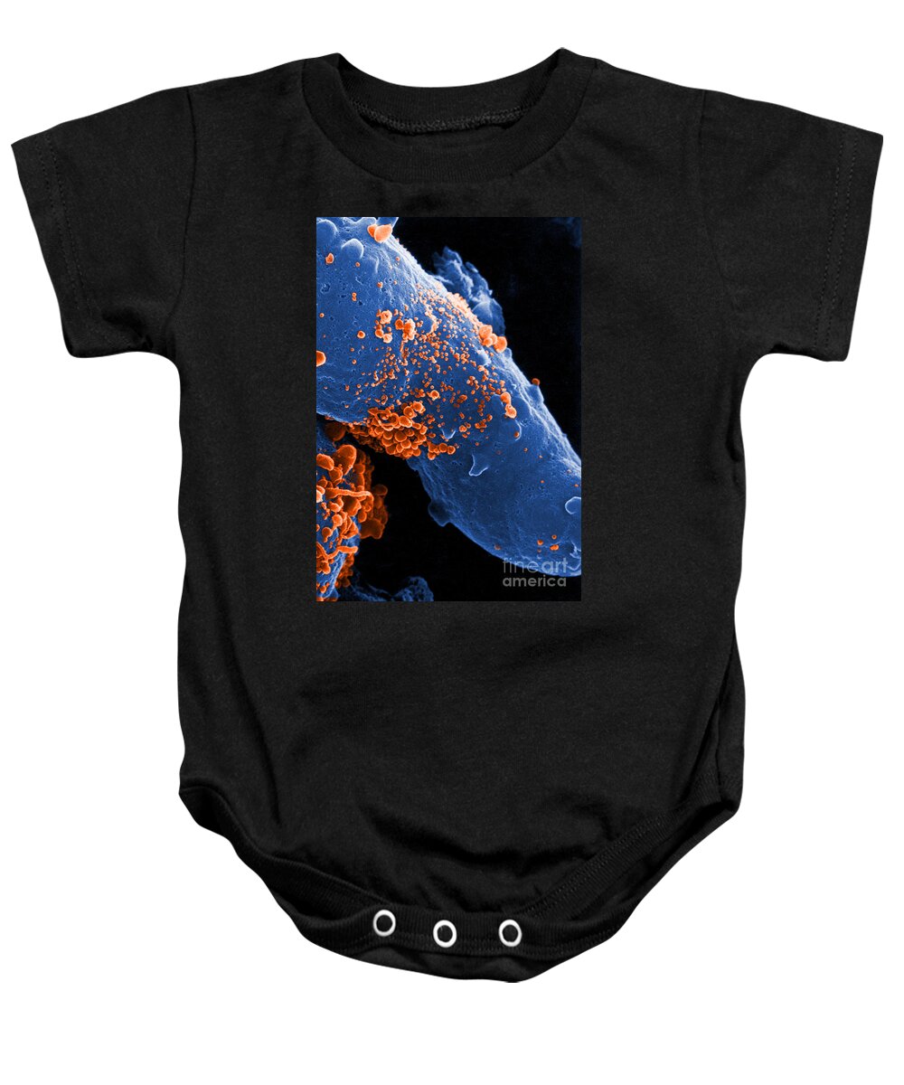 Science Baby Onesie featuring the photograph Aids Virus #4 by Dr. Cecil H. Fox