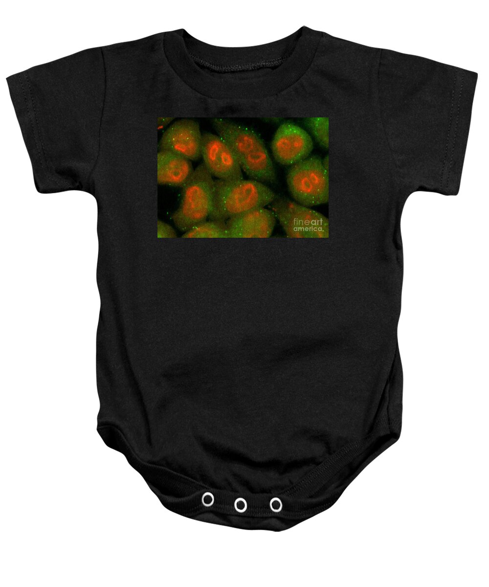 Tumoral Cell Baby Onesie featuring the photograph Nucleolin Confocal Micrograph #1 by Voisin Phanie