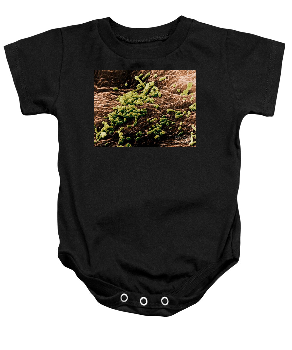 Sem Baby Onesie featuring the photograph Skin Bacteria, Sem by David M. Phillips