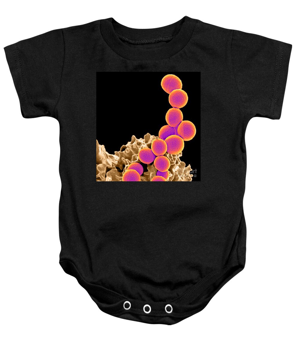 Microbiology Baby Onesie featuring the photograph Methicillin-resistant Staphylococcus #21 by Science Source