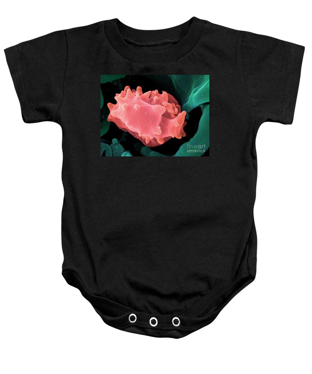 Lymphocyte Baby Onesie featuring the photograph Human Lymphocyte Cell, Sem #4 by Ted Kinsman