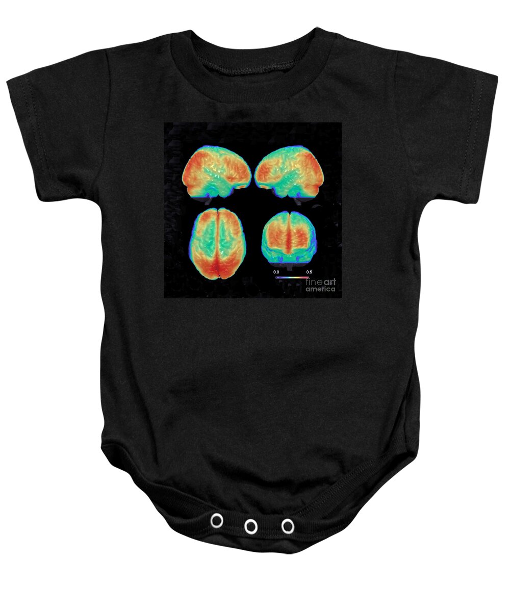 Science Baby Onesie featuring the photograph Bipolar Brain, 3d Mri Scan by Science Source