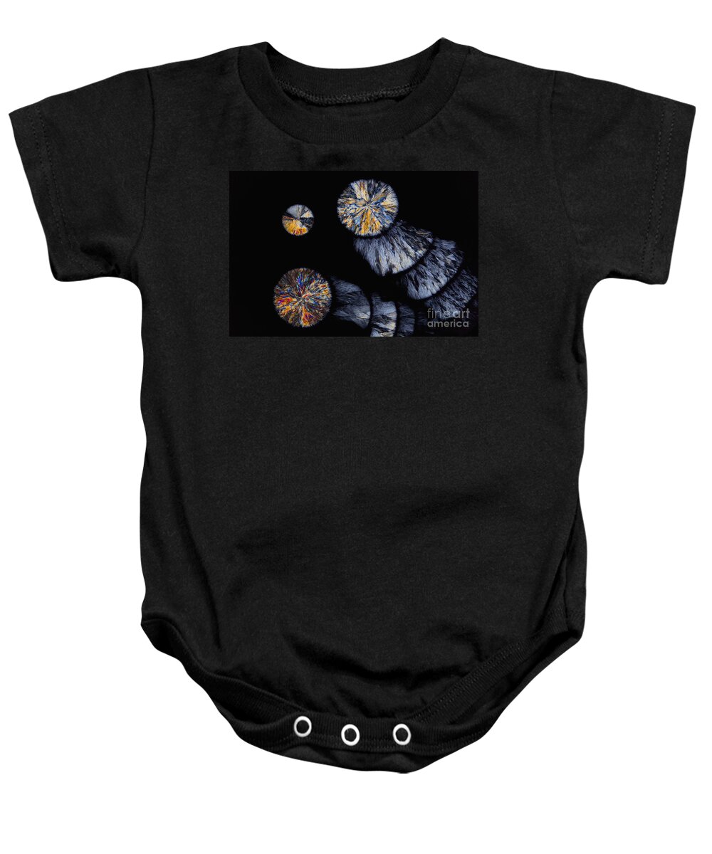 Atherosclerosis Baby Onesie featuring the photograph Cholesterol Crystals, Polarized Lm by Antonio Romero