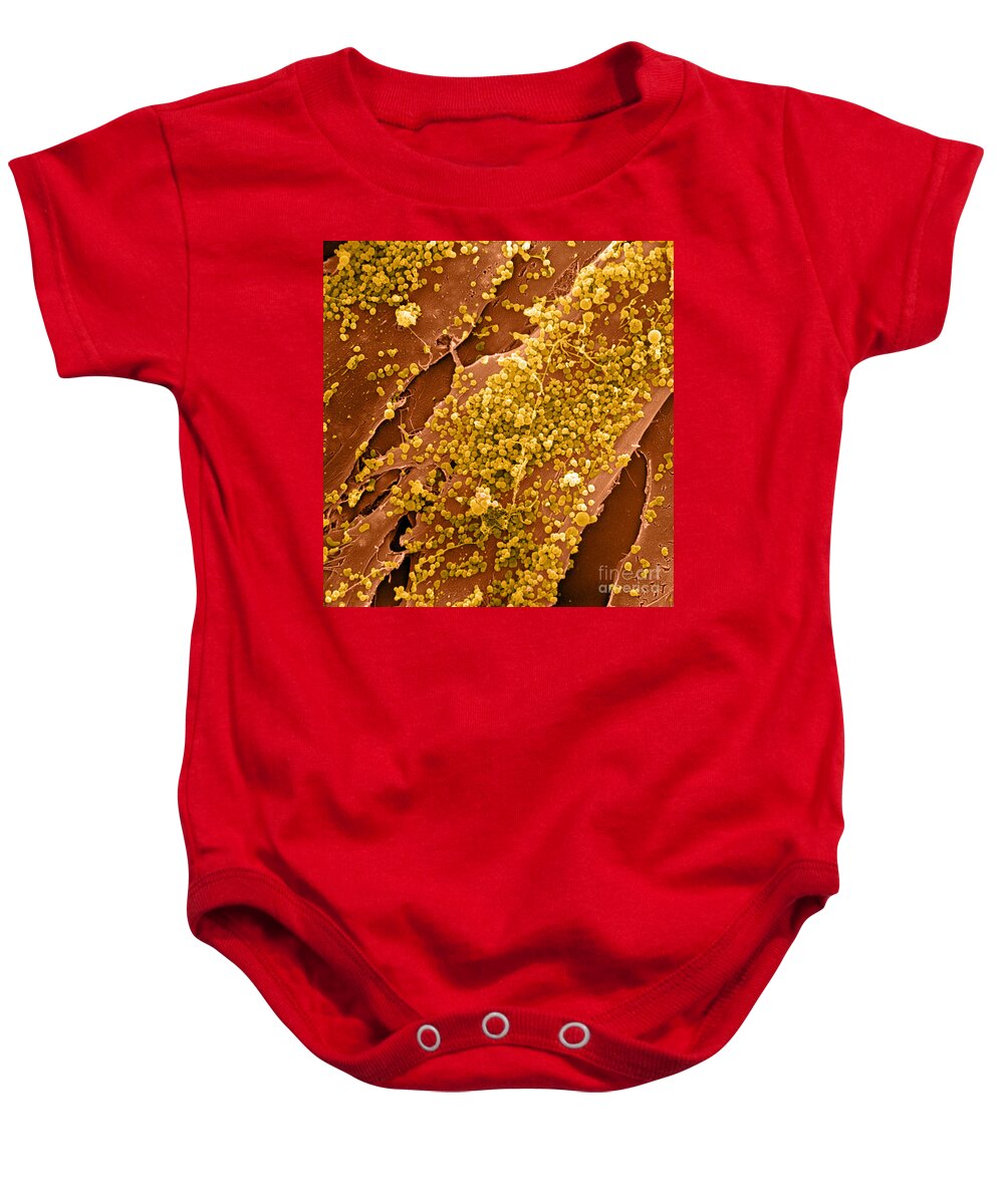 Cell Baby Onesie featuring the photograph Human Skin Cell Sem by David M. Phillips