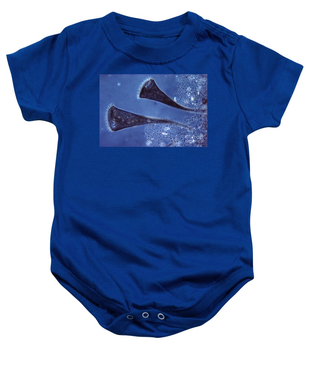 Micrograph Baby Onesie featuring the photograph Stentor Protist by Eric V. Grave